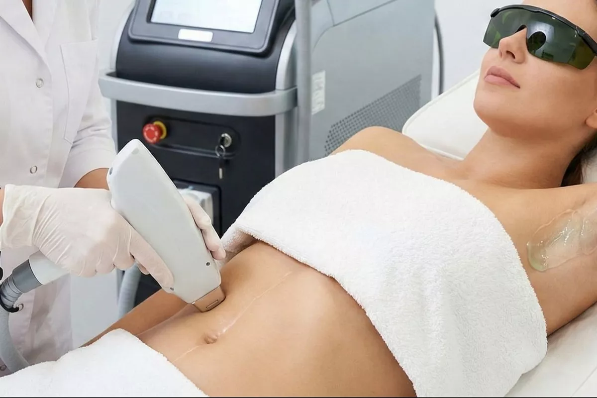 Épilation laser Aisselles + Ligne ombilicale