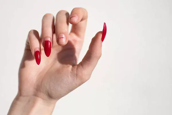Ongle cassé
