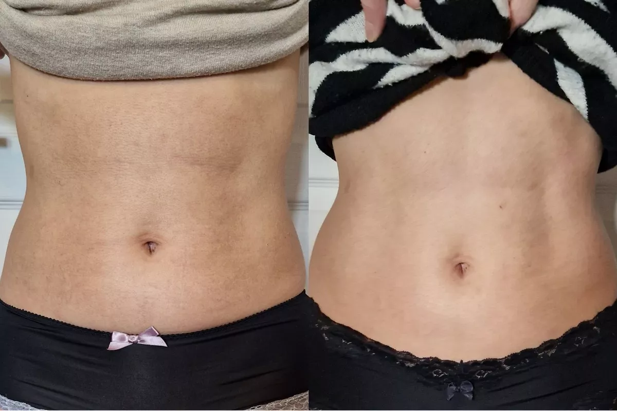 Body Sculpt Ventre Signature