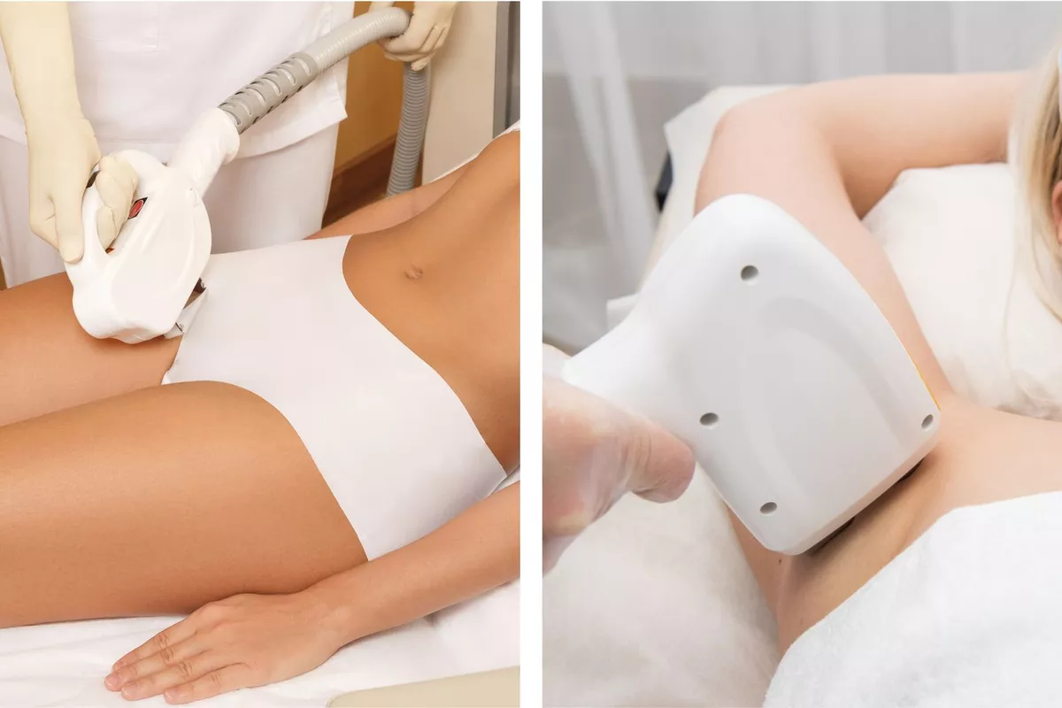Épilation Laser - Maillot brésilien + Aiselles + SIF offert