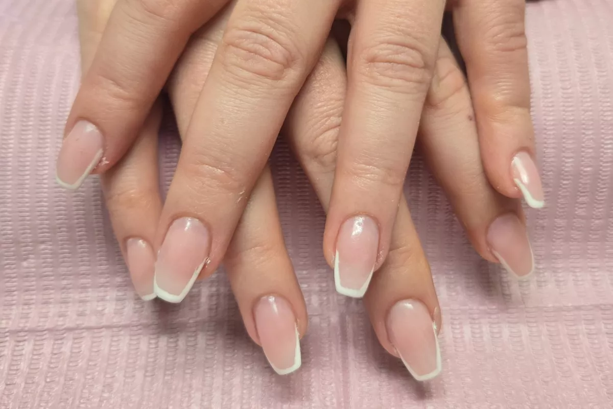 Remplissage résine ou gel 5 semaines