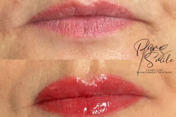 Maquillage Permanent des Lèvres ( Candy Lips )