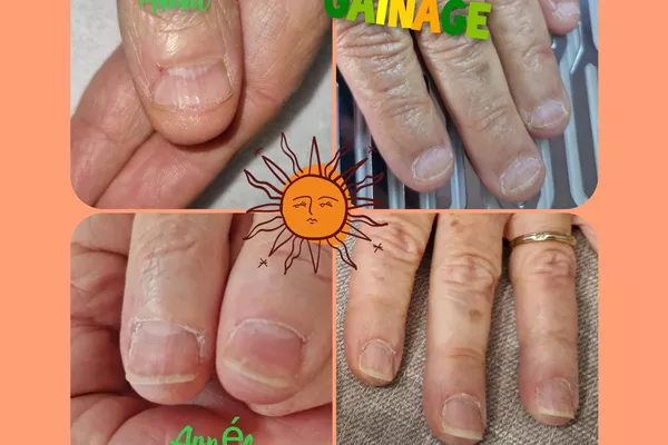 Gainage des ongles - renforcement et protection naturelle