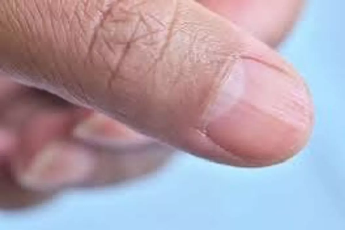 SOS Ongles abimés