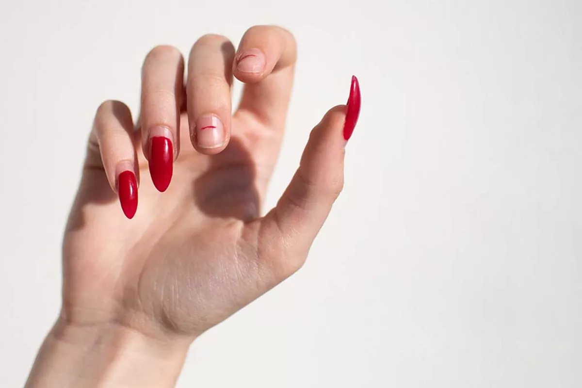 Ongle cassé