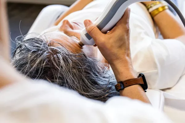 Peeling coup d’éclat