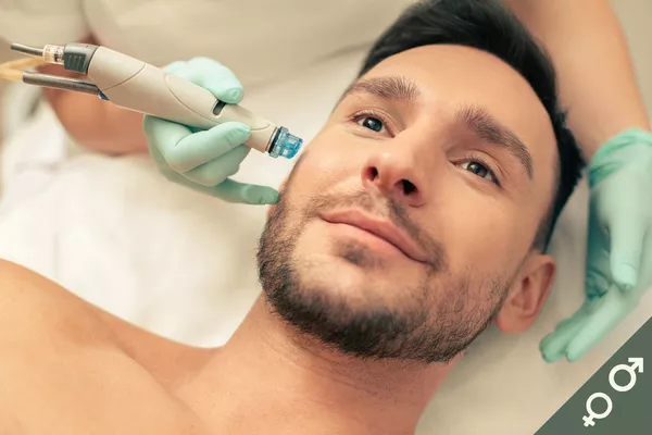 Micropeeling/Dermabrasion - Exfoliation précise & Renouvellement cellulaire