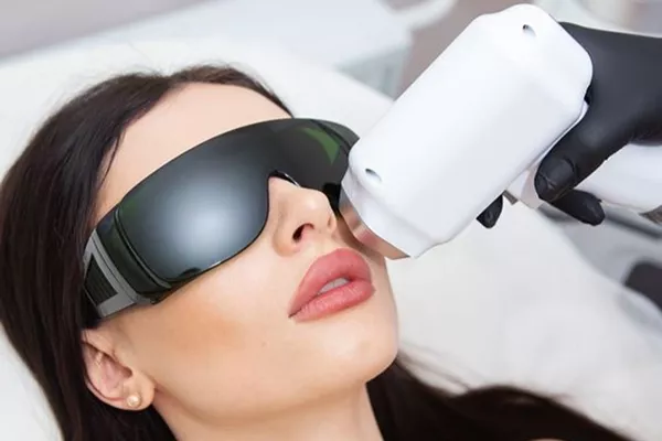 Épilation laser diode : Lèvres supérieure