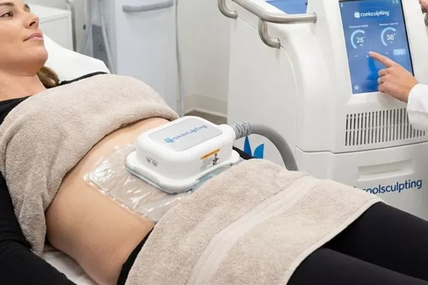 Séance de cryolipolyse ciblée – 1 zone