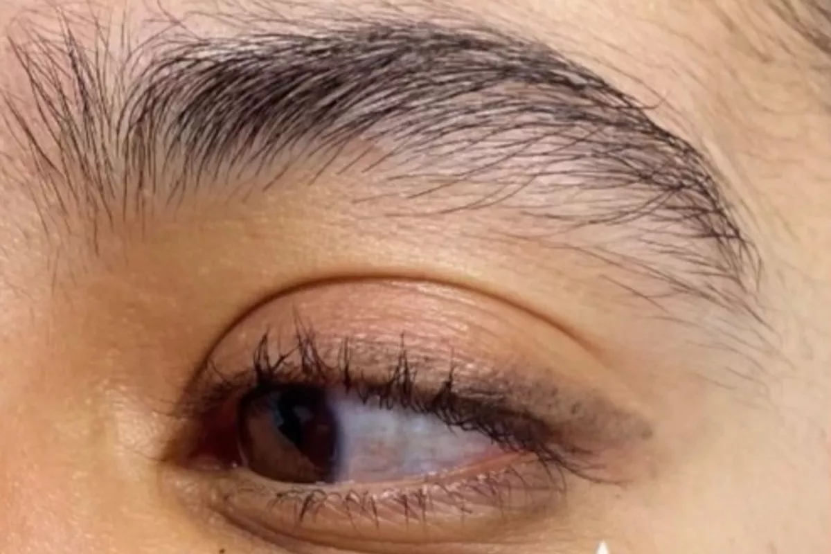 Épilation des sourcils par électrolyse – Femme & Homme