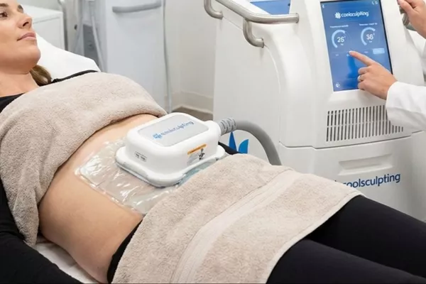 Séance d’essai cryolipolyse - 1 zone