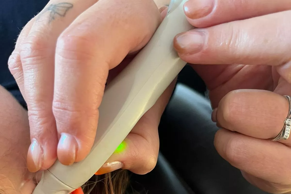 Auriculautherapie Laser Découverte