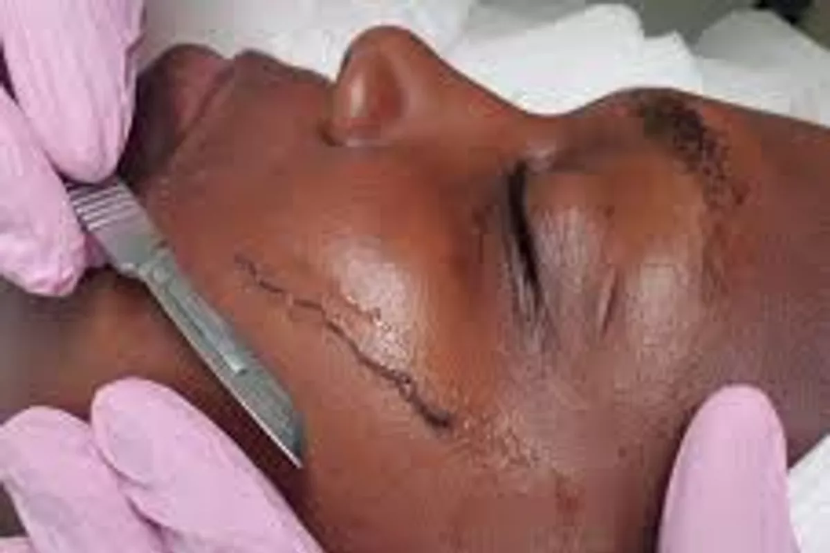 Experte en soins de visage Ploemeur