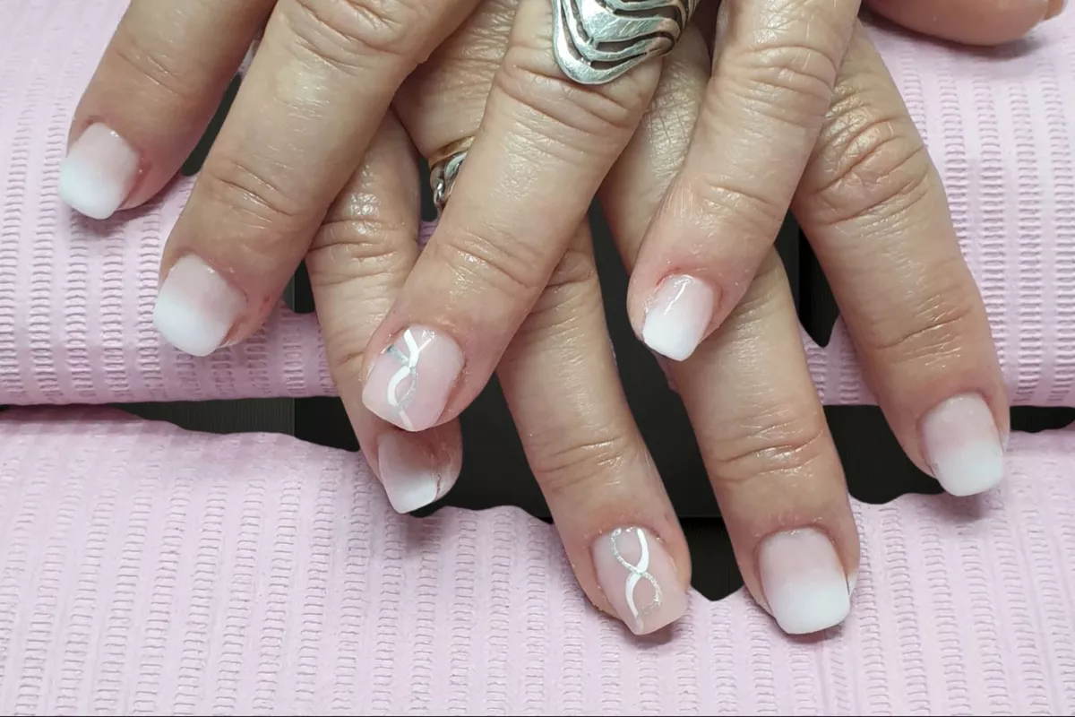 Remplissage résine ou gel 3 ou 4 semaines