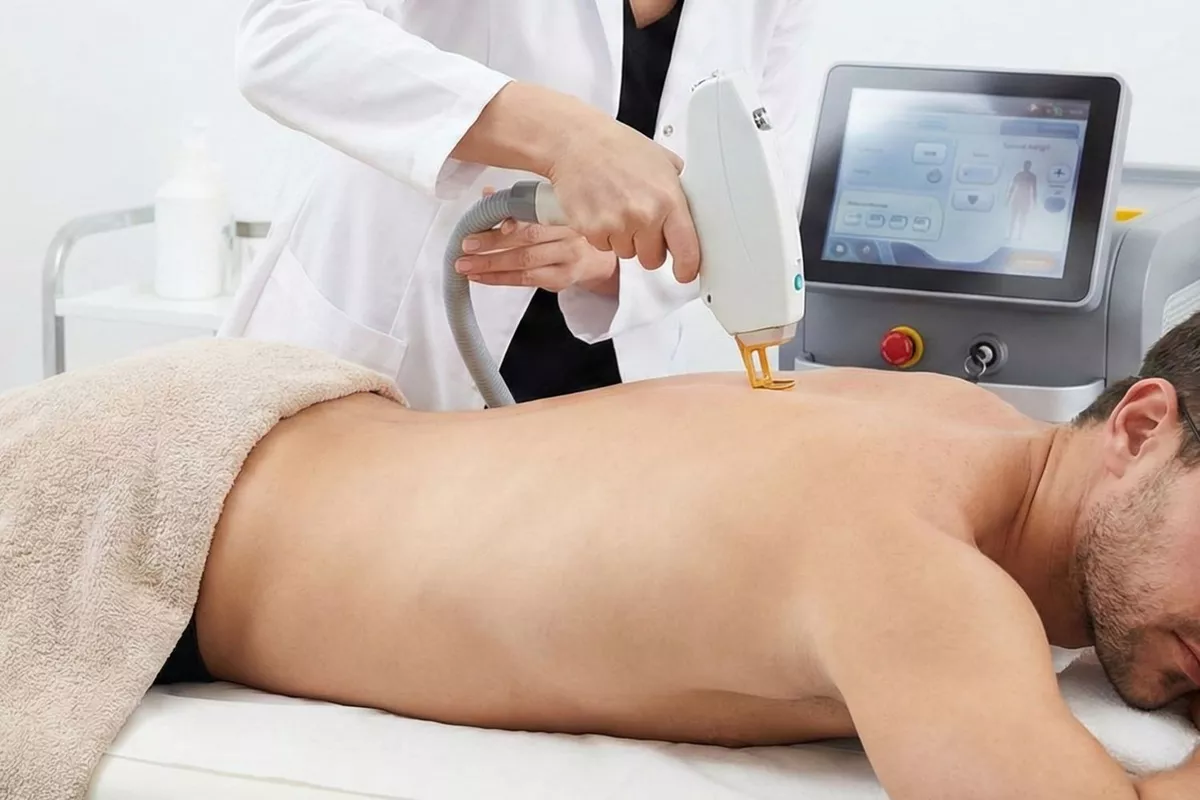 Épilation laser Dos