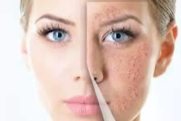 Essentiel Purifiant ( nettoyage de la peau en profondeur )