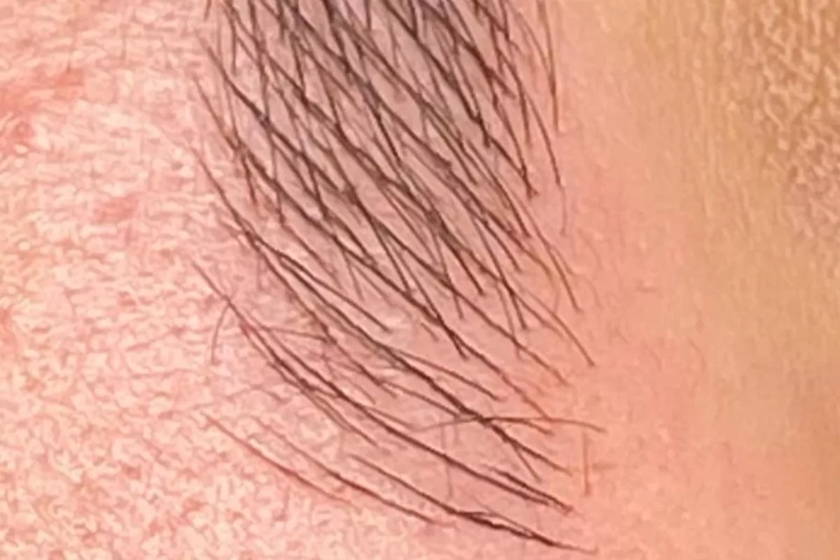 Microblading