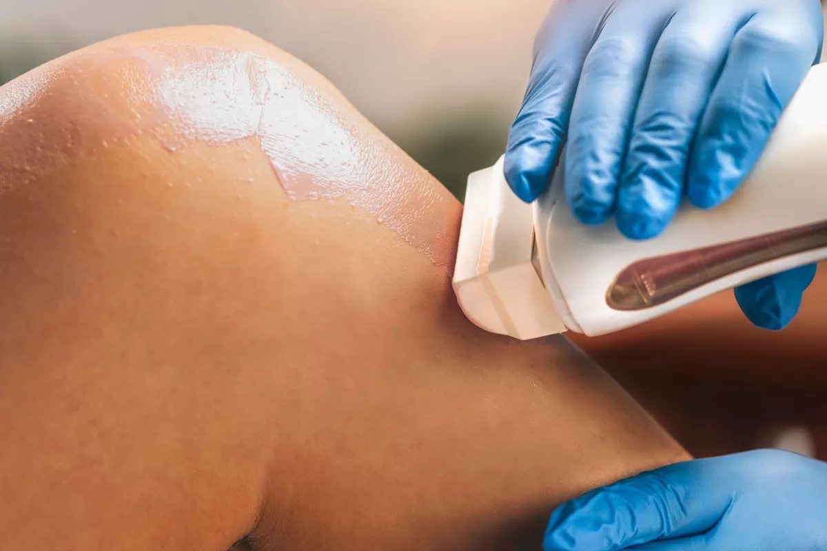 Epilation cuisses