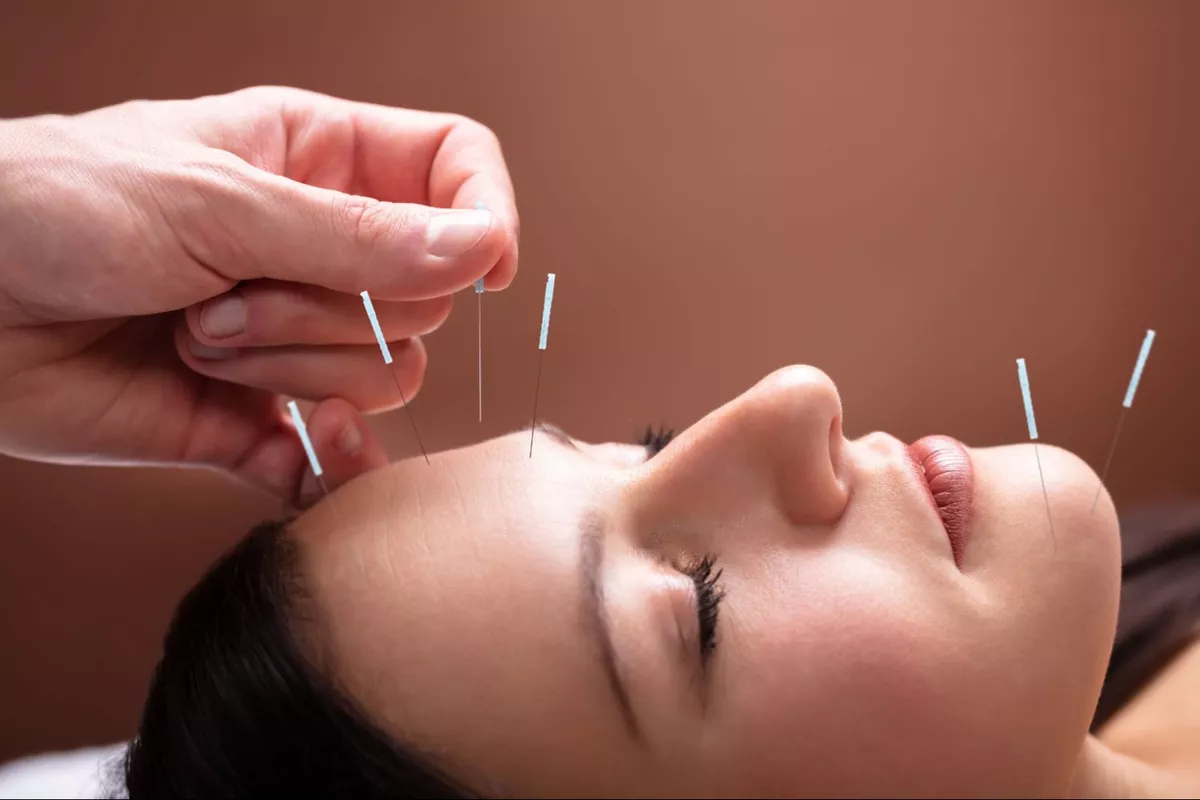 Rappel Aculifting