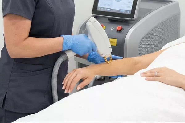 Épilation laser Bras complet ( mains offertes)