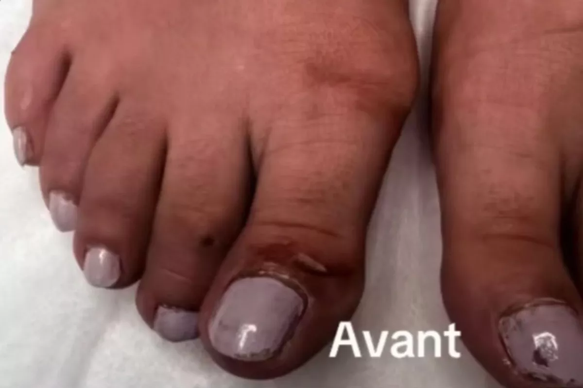 PEDICURE FEMME AVEC VERNIS SEMI-PERMANENT