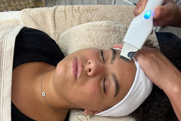 Microneedling