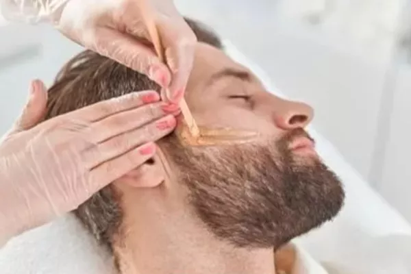 Epilation Joues