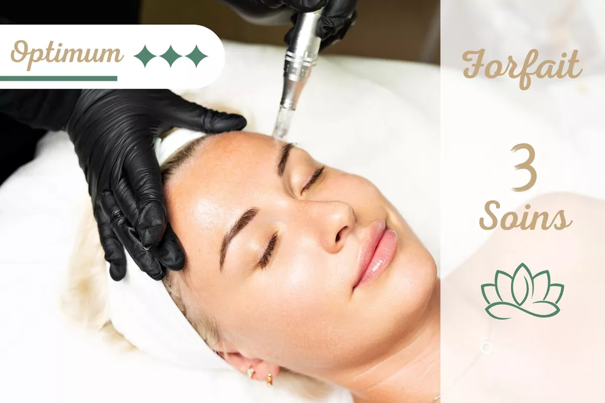 Forfait 3 soins - Oxyneedling Optimum