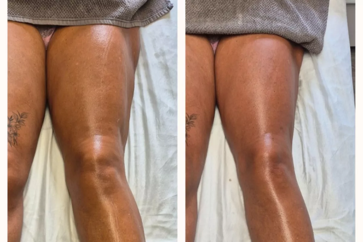 Body Sculpt Jambes Signature