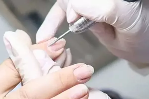 Dépose seule gel sur chablon
