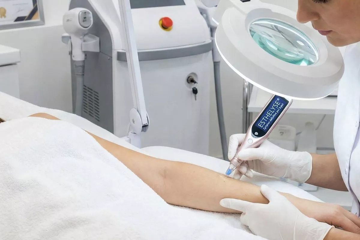 Séance 10 min - Épilation définitive poil à poil (Esthelyse)