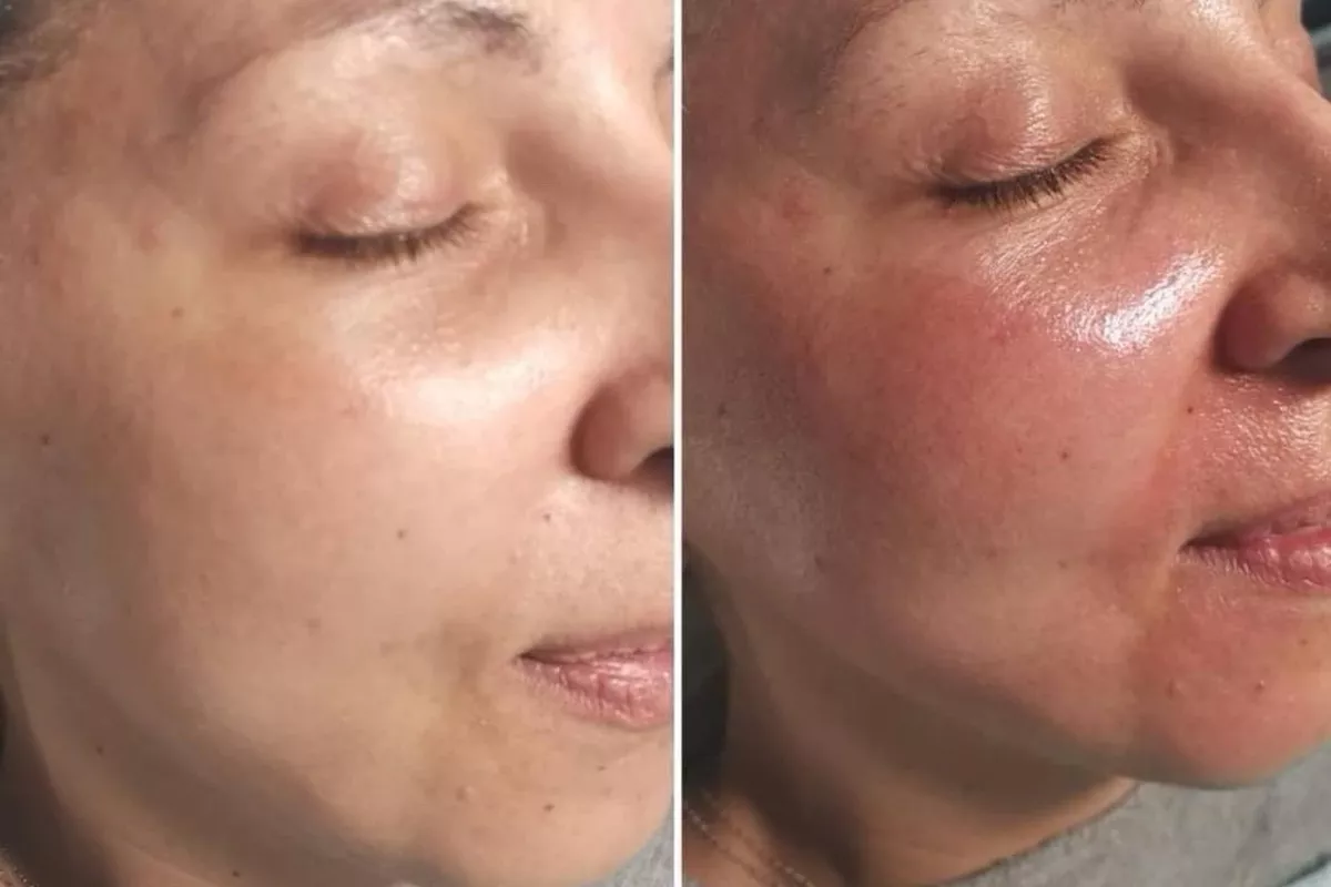 Experte en soins de visage Ploemeur