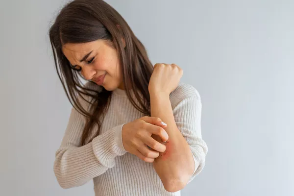 Magnétisme : consultation eczéma adulte