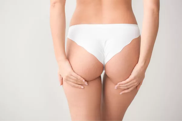 Épilation définitive corps au laser diode – Fesses
