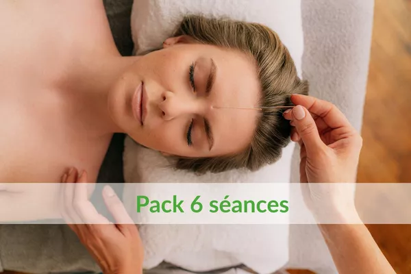 Pack 6 séances – Acupuncture esthétique du visage