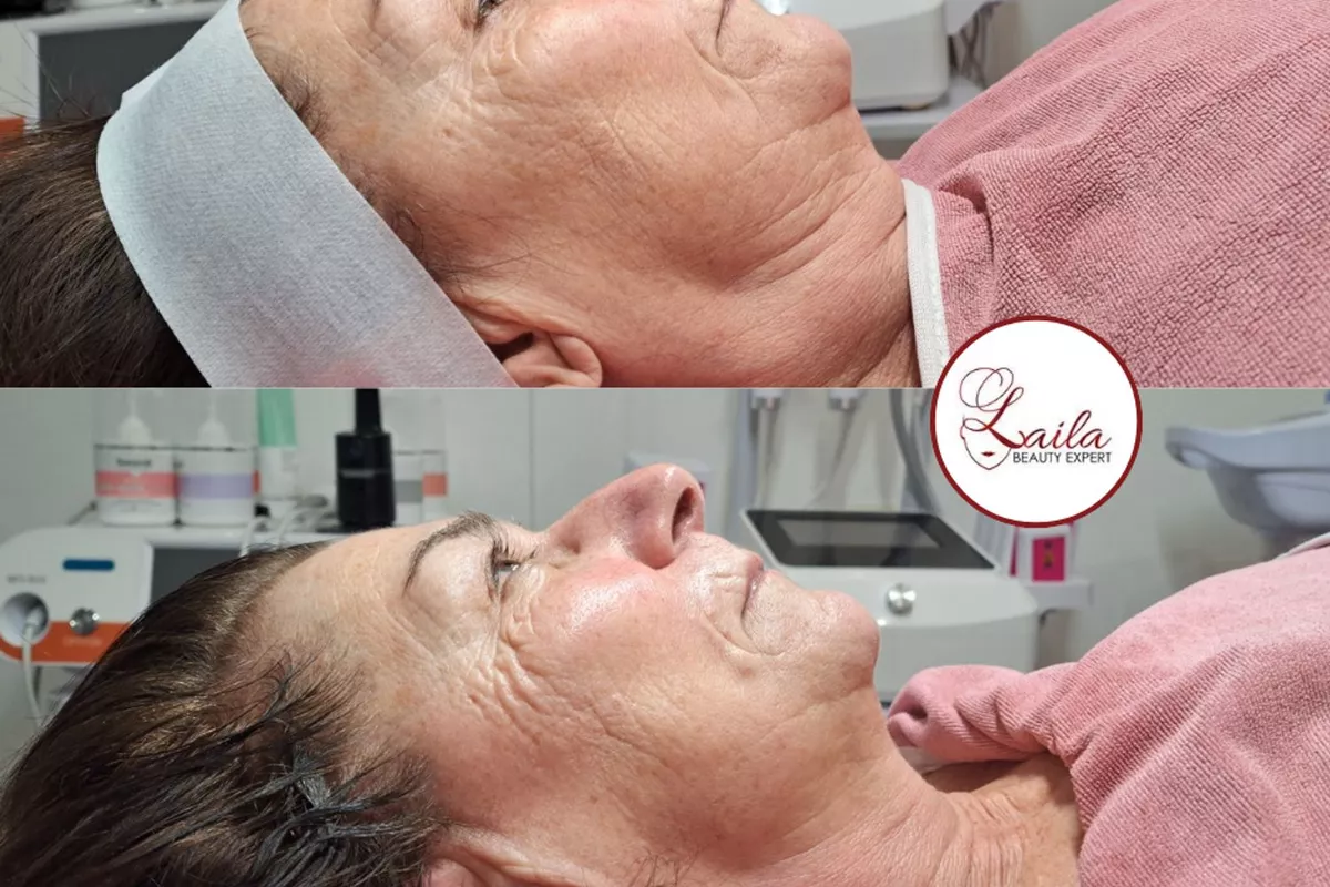 Soin de visage Bois-Guillaume