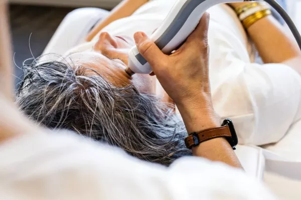 Peeling - Cure 6 séances anti-acné moins de 25 ans ( sur présentation d'un justificatif )