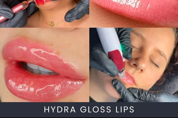 Hydra lips