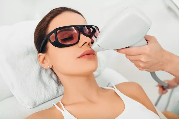 Épilation définitive visage au laser diode - Moustache