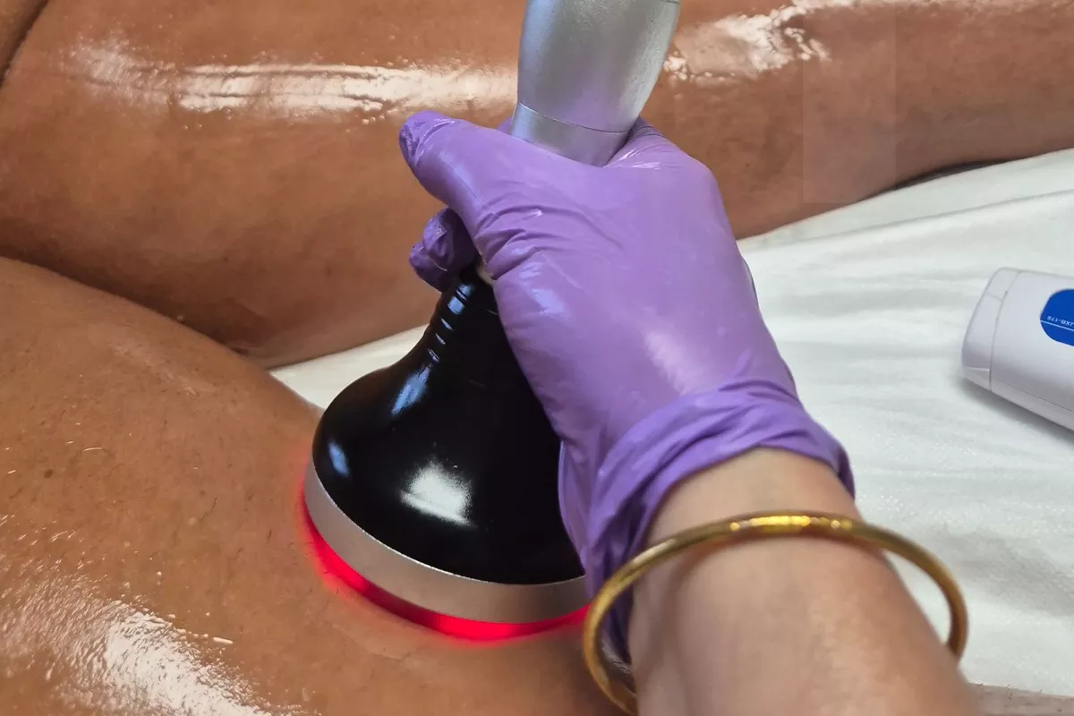 Cavitation ou RF  cuisses + fessiers