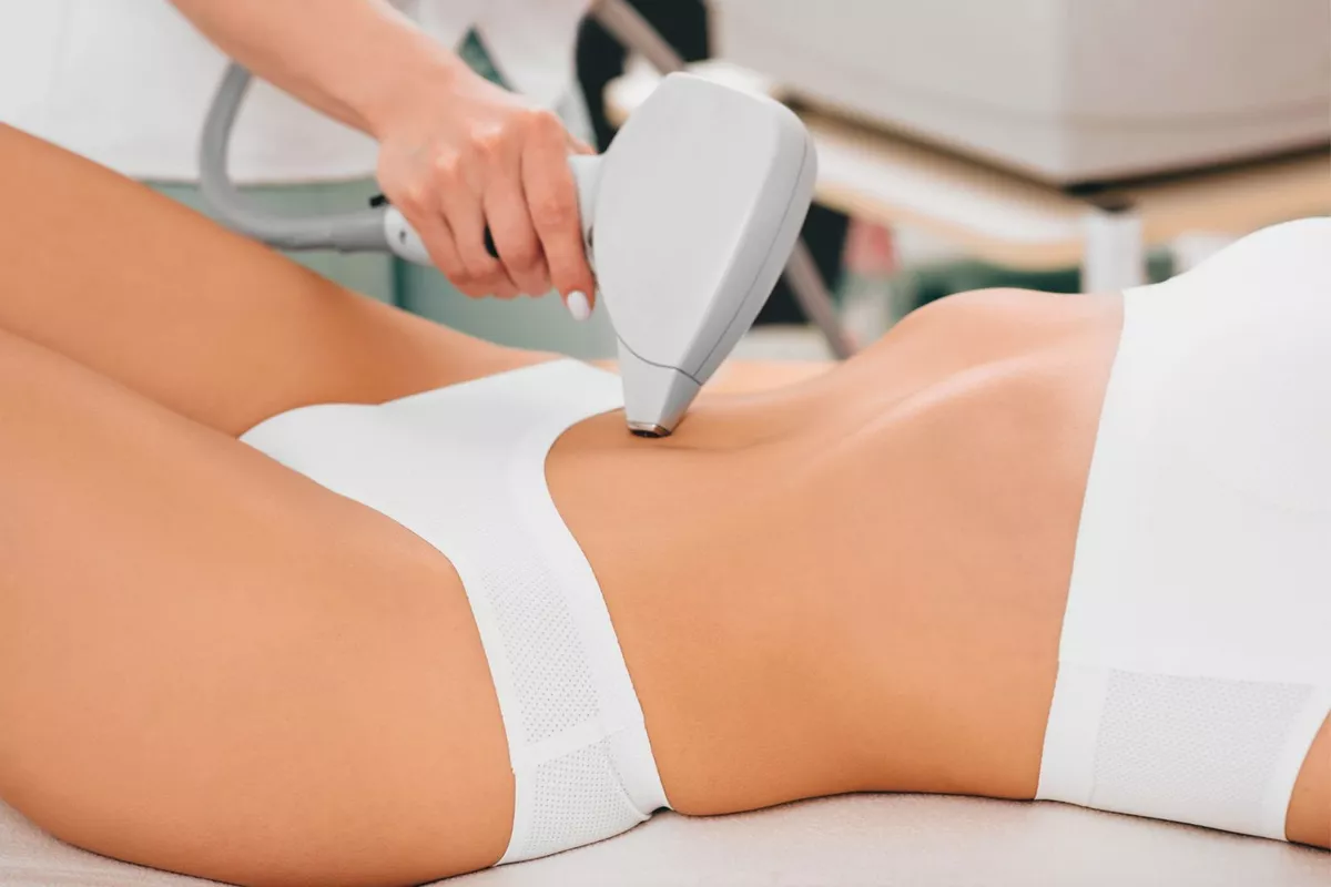 Épilation définitive corps au laser diode – Ventre