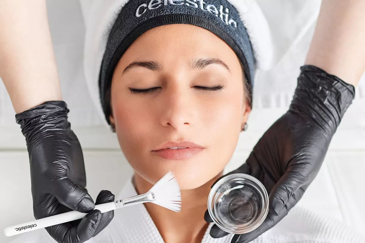 Peeling Visage Acné, rides, Pigmentation, Cicatrices