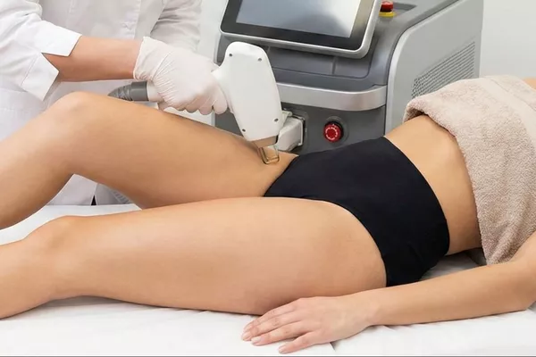 Épilation laser Maillot complet (SIF offert)