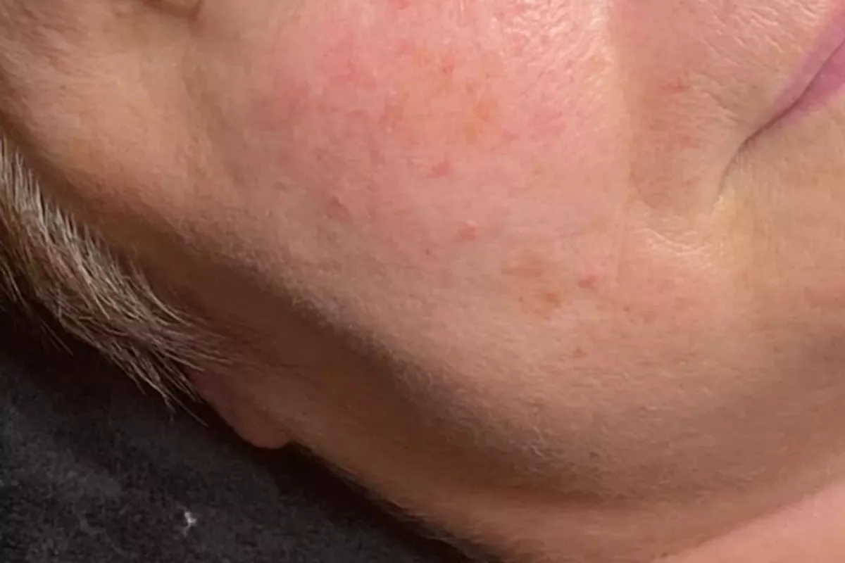 Visage complet au fil