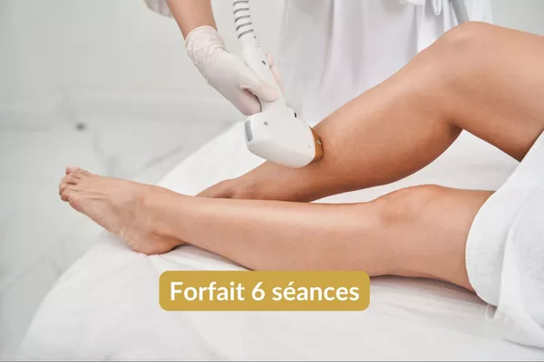 Épilation lumière pulsée Demi-jambes - Forfait 6 séances
