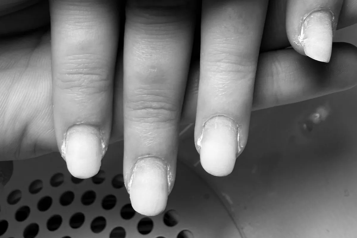 Remplissage – Ongles Rongés (Valable les 3 premiers remplissages)