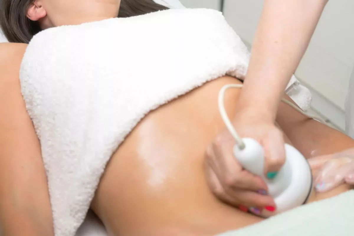 Lipocavitation par zone – Minceur ciblée sans chirurgie