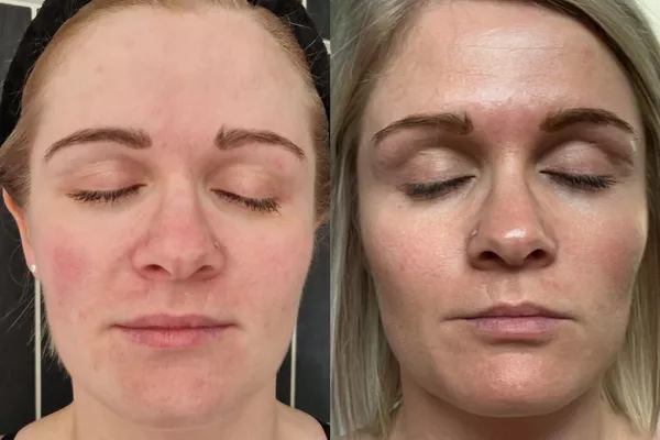 Soin bronzant Hydra Sun visage