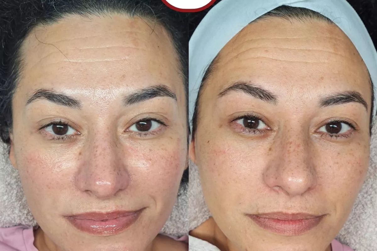 Soins amincissants Bois-Guillaume