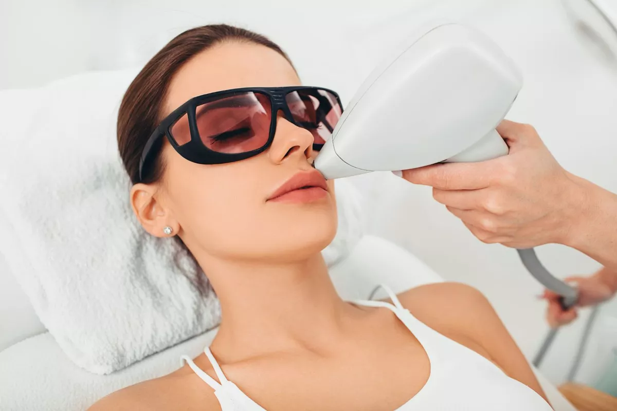 Épilation définitive visage au laser diode - Moustache